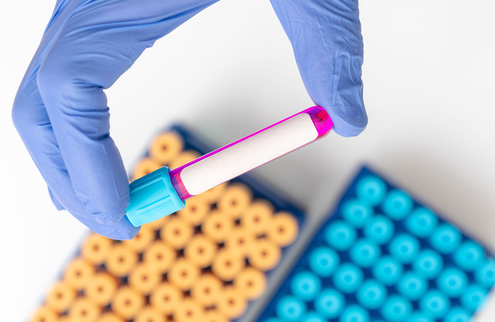 Stop! In the Name of Coagulation 