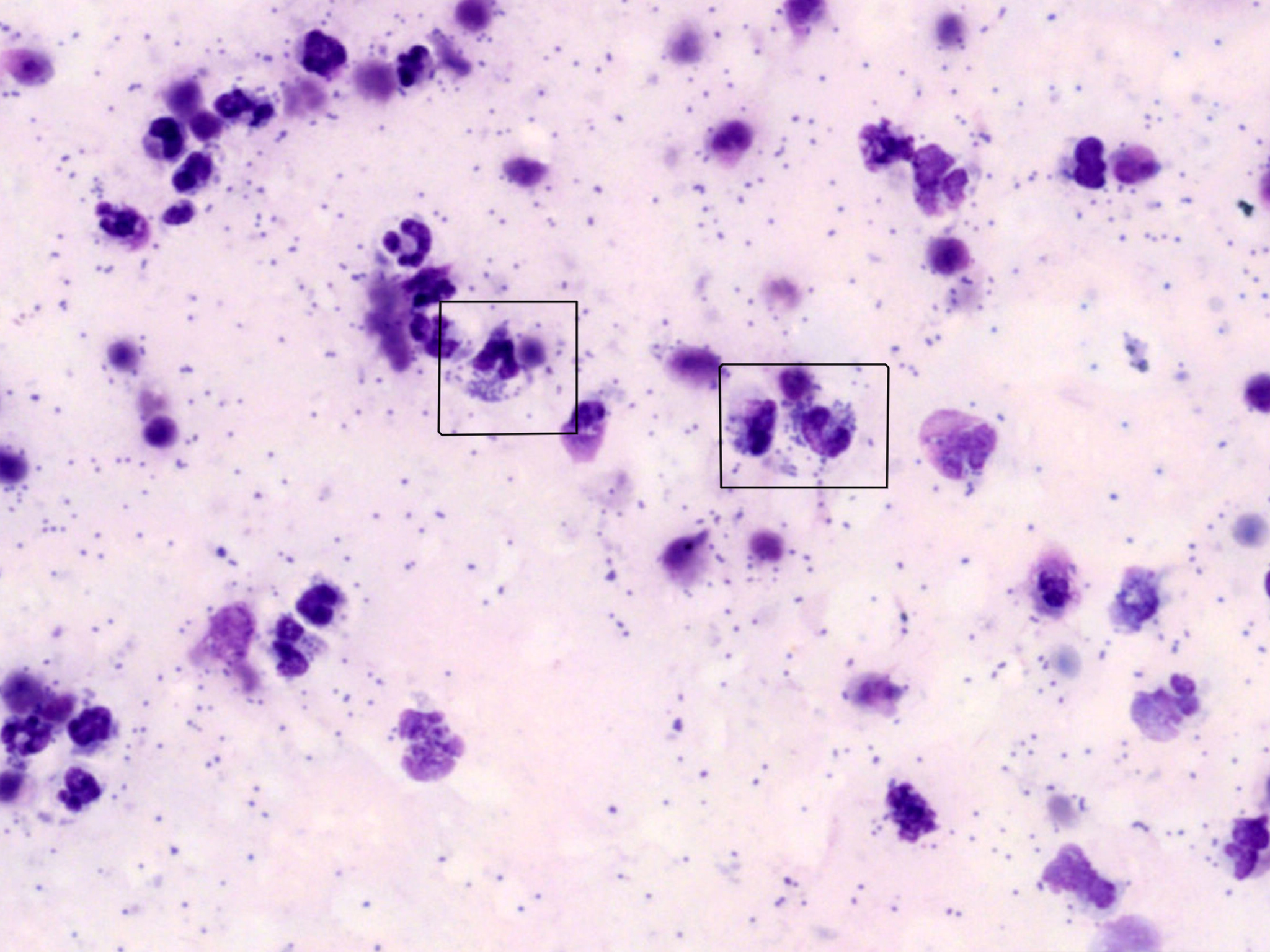 Let’s Get Technical: The Case for Effusion Analysis